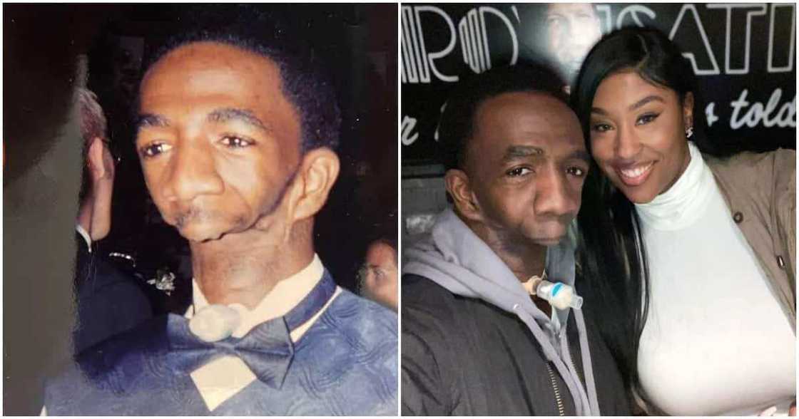 Joseph Williams: Man Born Without Jaw Marries Beautiful Lady. Joseph Williams: Man Born Without Jaw Marries Beautiful Lady.