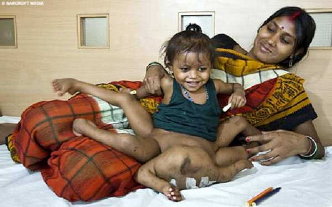 Ikon Allah: Wata yarinya da aka haifa da kafafu da hannaye hudu ta cika shekaru 2, hotuna Ikon Allah: Wata yarinya da aka haifa da kafafu da hannaye hudu ta cika shekaru 2, hotuna