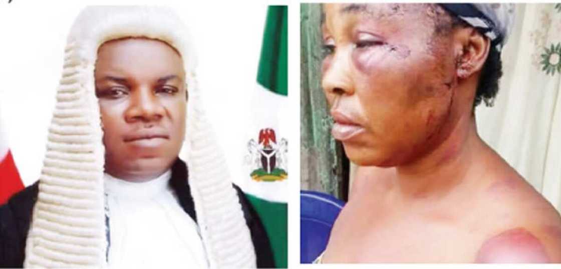 Kansila a jihar Rivers ya yi wa matar yayansa mugun duka Kansila a jihar Rivers ya yi wa matar yayansa mugun duka