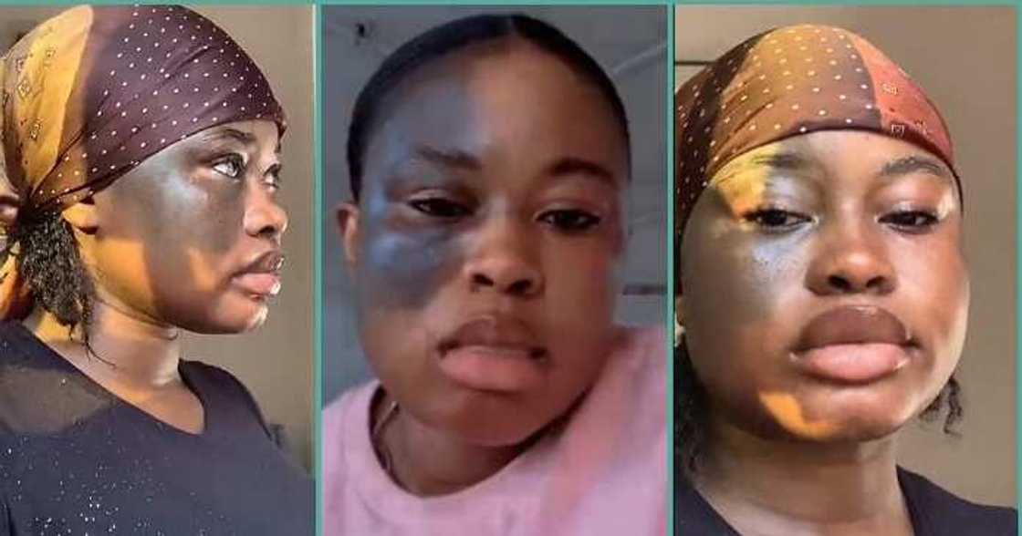 Nigerian lady who has a unique birthmark shares her ordeal Nigerian lady who has a unique birthmark shares her ordeal