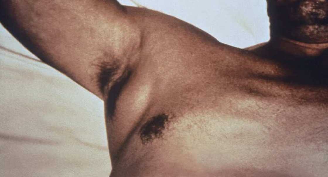 An samu bullar wata mugunyar cuta mai yaduwa a China An samu bullar wata mugunyar cuta mai yaduwa a China