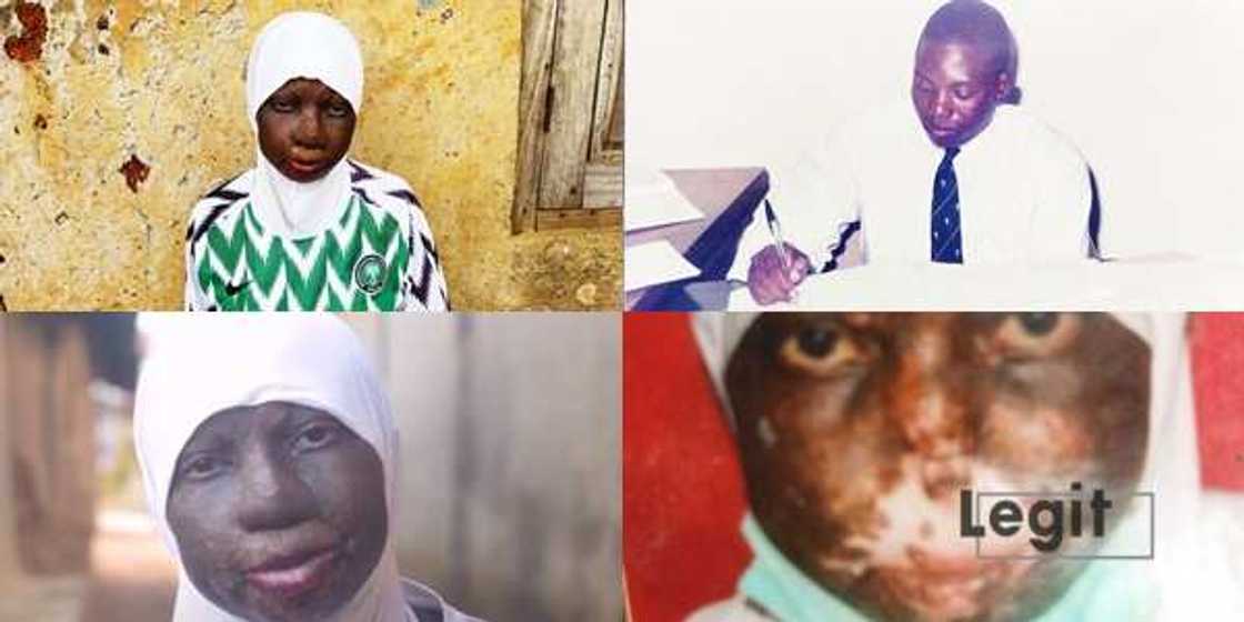 I cannot breathe - Rokeebat needs N2m to save her life from deadly nose infection