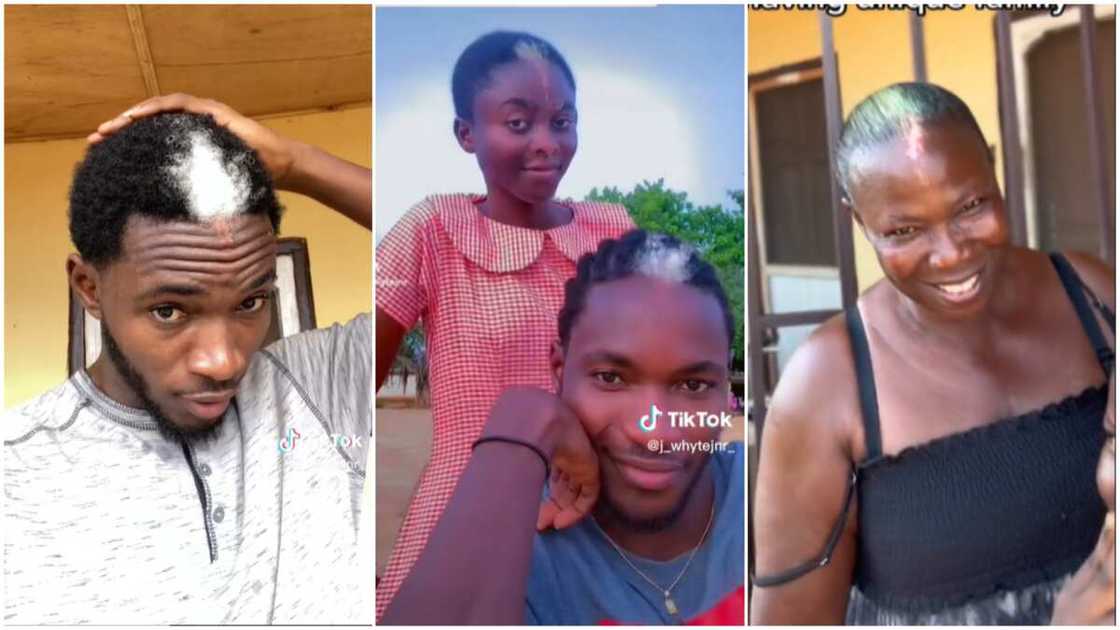 Unique birth marks/family members with front white hair. Unique birth marks/family members with front white hair.