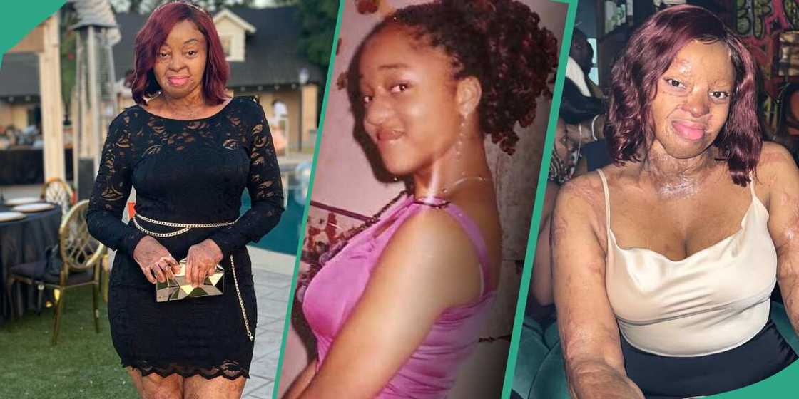 Plane crash survivor Kechi Okwuchi shares old photo before the crash. Plane crash survivor Kechi Okwuchi shares old photo before the crash.