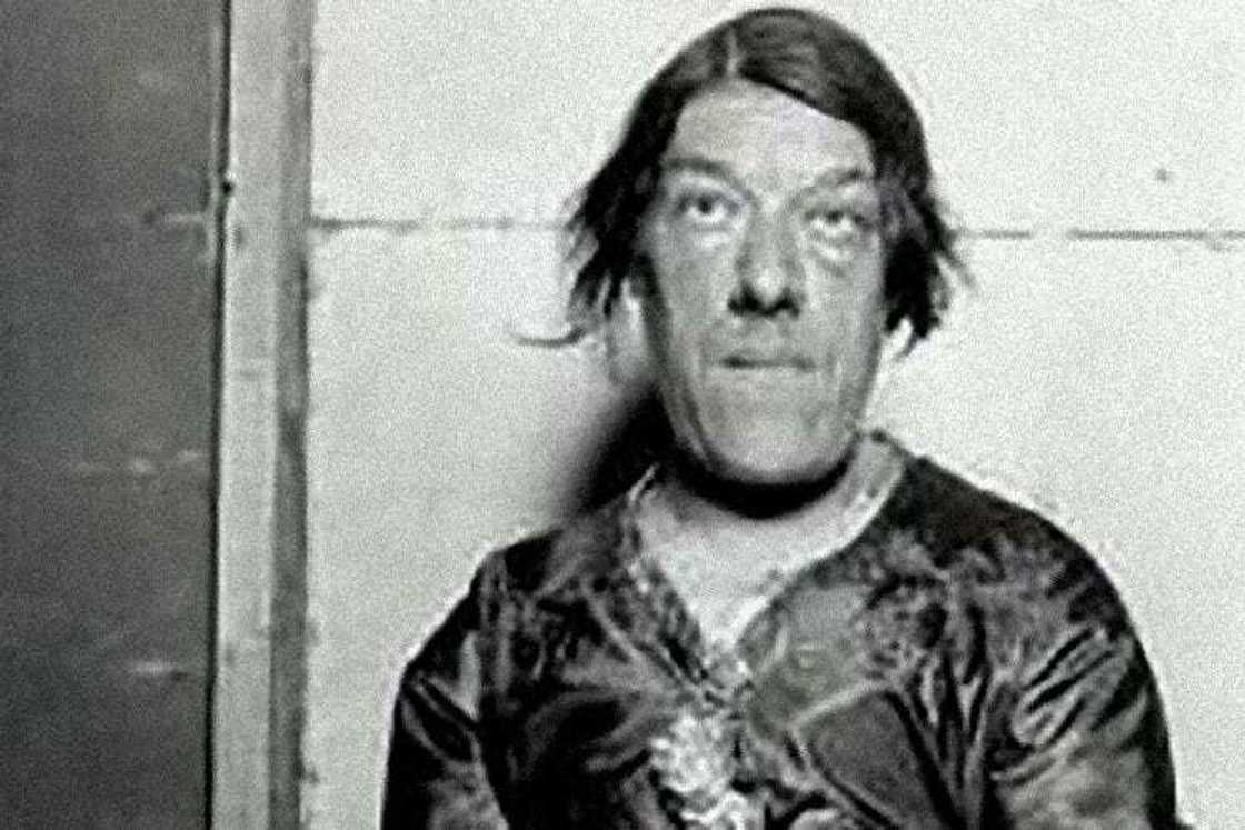 Labarin Mary Ann: Hotunan Matar da ta fi kowa muni a duniya kuma ta ci gasar munana Labarin Mary Ann: Hotunan Matar da ta fi kowa muni a duniya kuma ta ci gasar munana