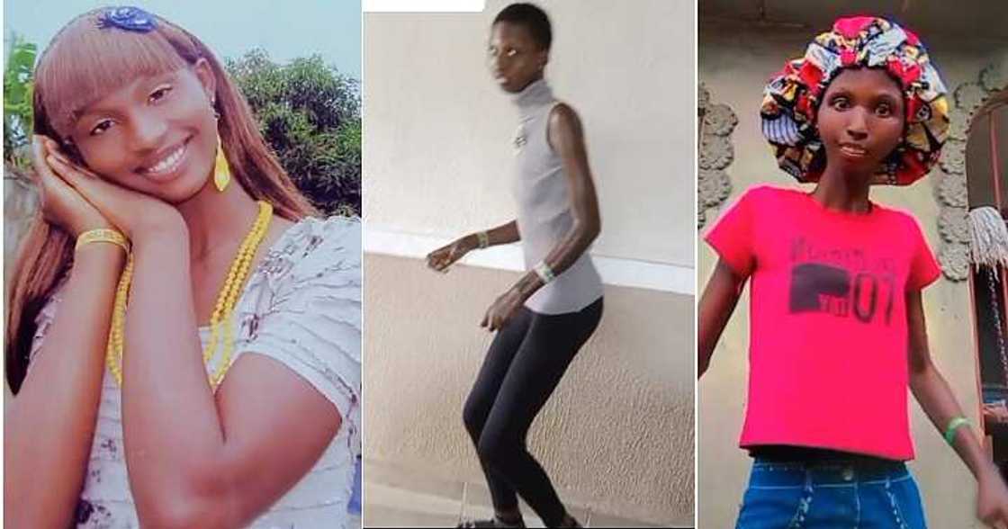 Lady diagnosed with scleroderma, throwback video Lady diagnosed with scleroderma, throwback video
