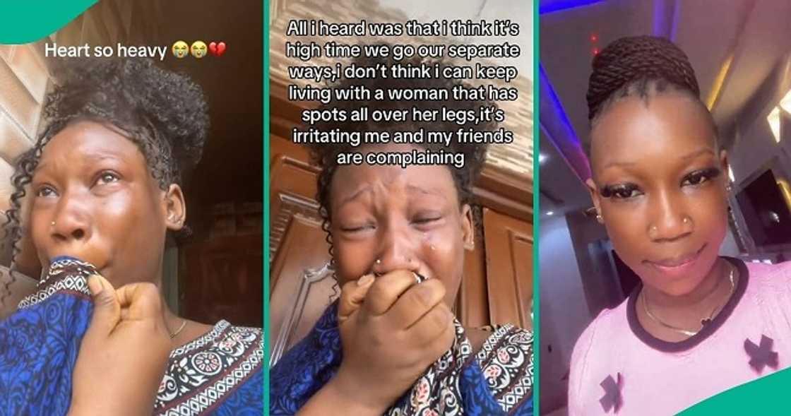 Man quits marriage as wife develops spots on her legs. Man quits marriage as wife develops spots on her legs.