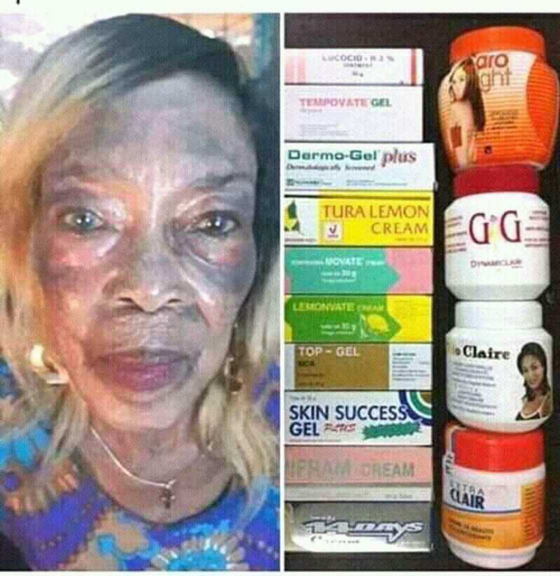 Manyan illoli 2 dake tattare da man sauya launin fata da yan mata ke amfani dasu Manyan illoli 2 dake tattare da man sauya launin fata da yan mata ke amfani dasu