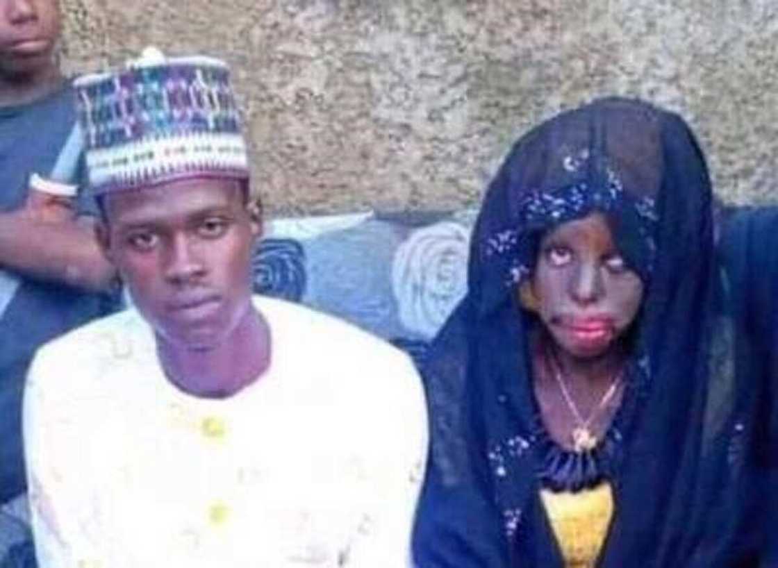 Matar mutum kabarinsa: Matashi ya angwance da wata budurwa duk da nakasar da take da ita Matar mutum kabarinsa: Matashi ya angwance da wata budurwa duk da nakasar da take da ita