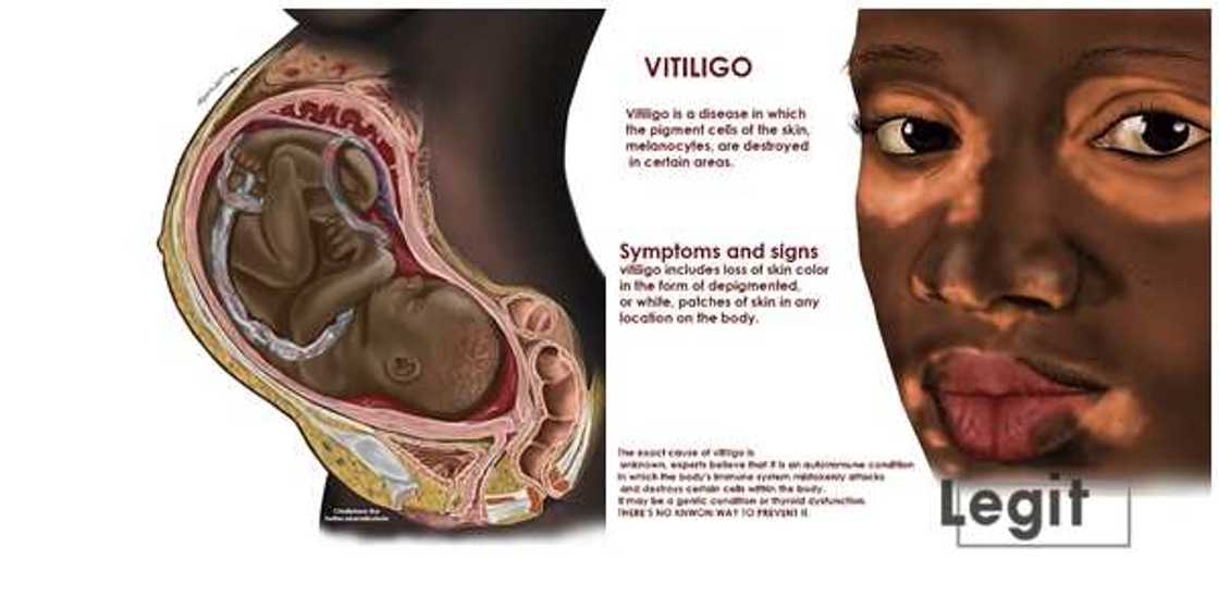 "I Wrote JAMB 5 Times," says Nigerian Student Behind Viral Black Medical Illustrations "I Wrote JAMB 5 Times," says Nigerian Student Behind Viral Black Medical Illustrations