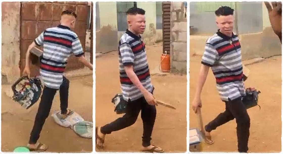 Photos of an albino who is a shoemaker.