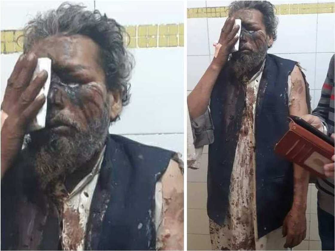 Wata sabuwa: Mabiya addinin Hindu sun watsawa wani Limamin Masallaci guba a fuska Wata sabuwa: Mabiya addinin Hindu sun watsawa wani Limamin Masallaci guba a fuska