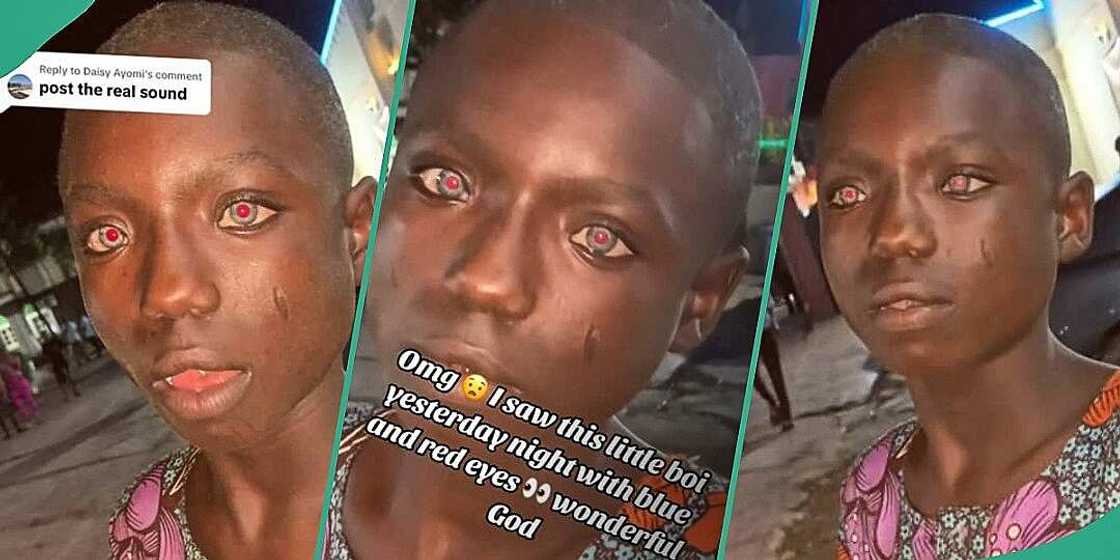 Boy with red and blue eyes goes viral Boy with red and blue eyes goes viral