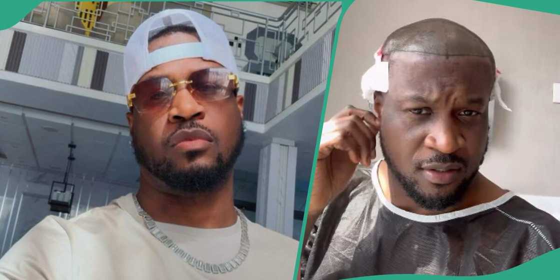 Singer Peter PSquare undergoes hair transplant.