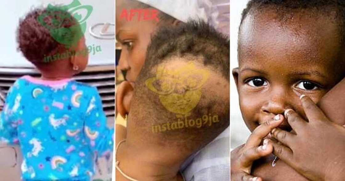 Mum finds out daughter's hair was shaved and an incision was made on her head Mum finds out daughter's hair was shaved and an incision was made on her head