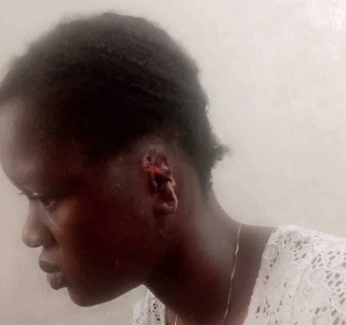 Hotunan budurwar da tsohon dan sanda ya fizge wa kunne da cizo Hotunan budurwar da tsohon dan sanda ya fizge wa kunne da cizo