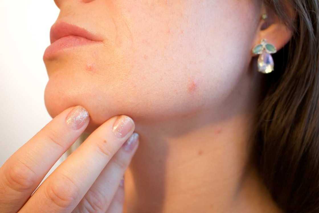One of the most common skin diseases - acne One of the most common skin diseases - acne