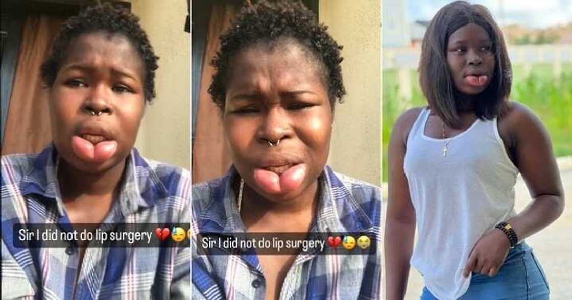 Lady with swollen lips says she never did surgery Lady with swollen lips says she never did surgery