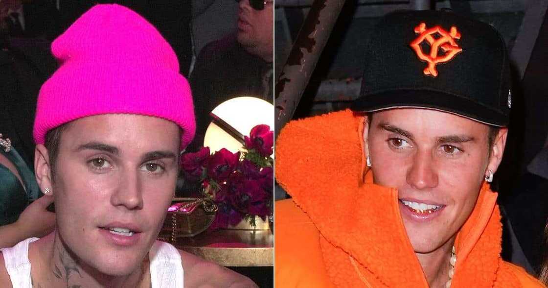 Justin Bieber, pop star, singer, musician, Ramsay Hunt Syndrome, Justin Bieber facial paralysis, artist, grammy winning artist, 'Justice' World Tour Justin Bieber, pop star, singer, musician, Ramsay Hunt Syndrome, Justin Bieber facial paralysis, artist, grammy winning artist, 'Justice' World Tour