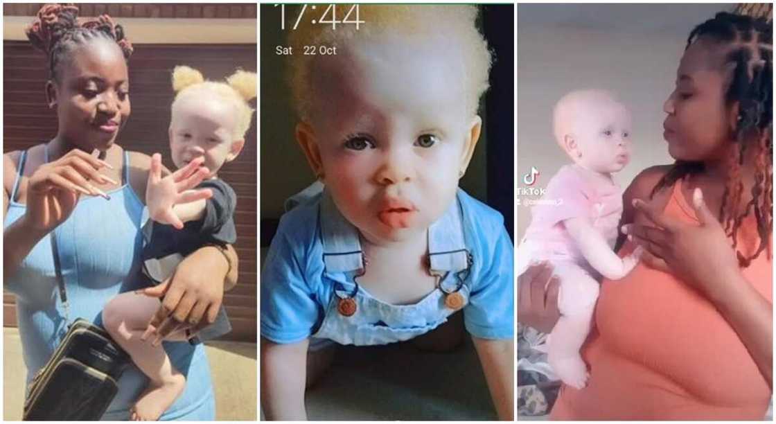 Queen Celestina Mung and her baby girl who is born an albino. Queen Celestina Mung and her baby girl who is born an albino.