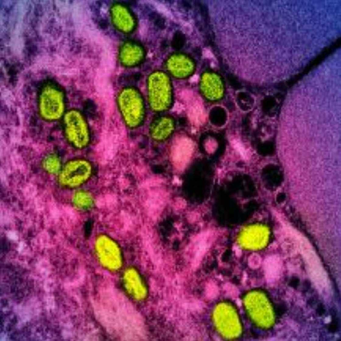 The disease was first discovered in humans in 1970 The disease was first discovered in humans in 1970