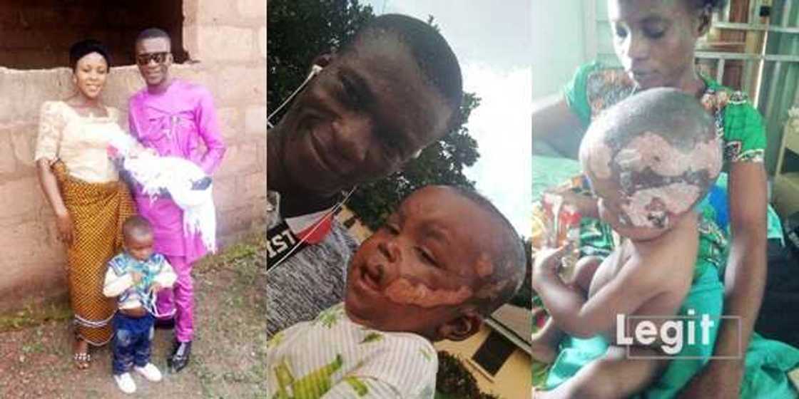 Kenneth Ogagbo: Help 1-year-old boy who lost his mum to fire accident to beat burns Kenneth Ogagbo: Help 1-year-old boy who lost his mum to fire accident to beat burns