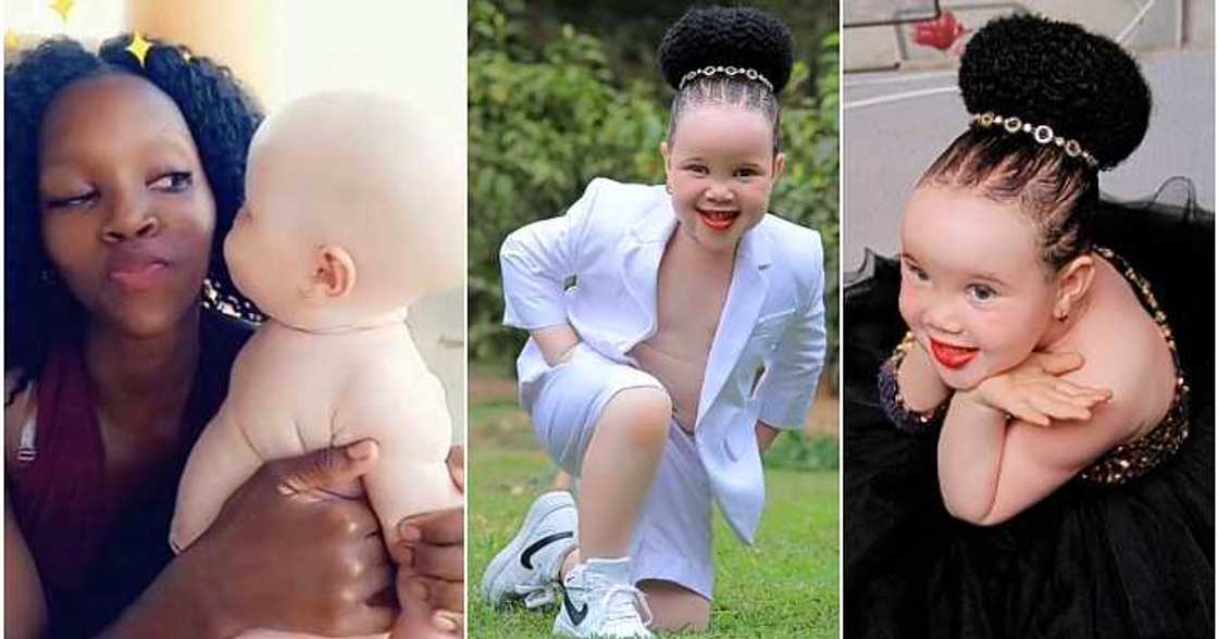 Albino girl rejected by dad, transformation Albino girl rejected by dad, transformation
