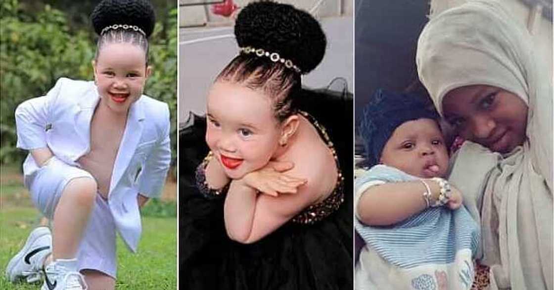 Deadbeat fathers, little girl with albinism Deadbeat fathers, little girl with albinism