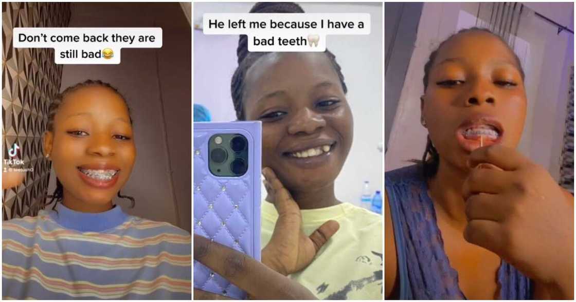 Braces, Nigerian lady, before versus after photos of lady with bad teeth, lady shows new braces Braces, Nigerian lady, before versus after photos of lady with bad teeth, lady shows new braces