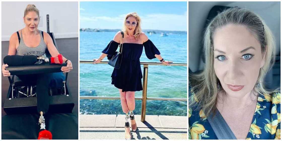 52-year-old Australian woman loses her legs, undergoes 36 surgeries after mosquito bit her in Nigeria 52-year-old Australian woman loses her legs, undergoes 36 surgeries after mosquito bit her in Nigeria