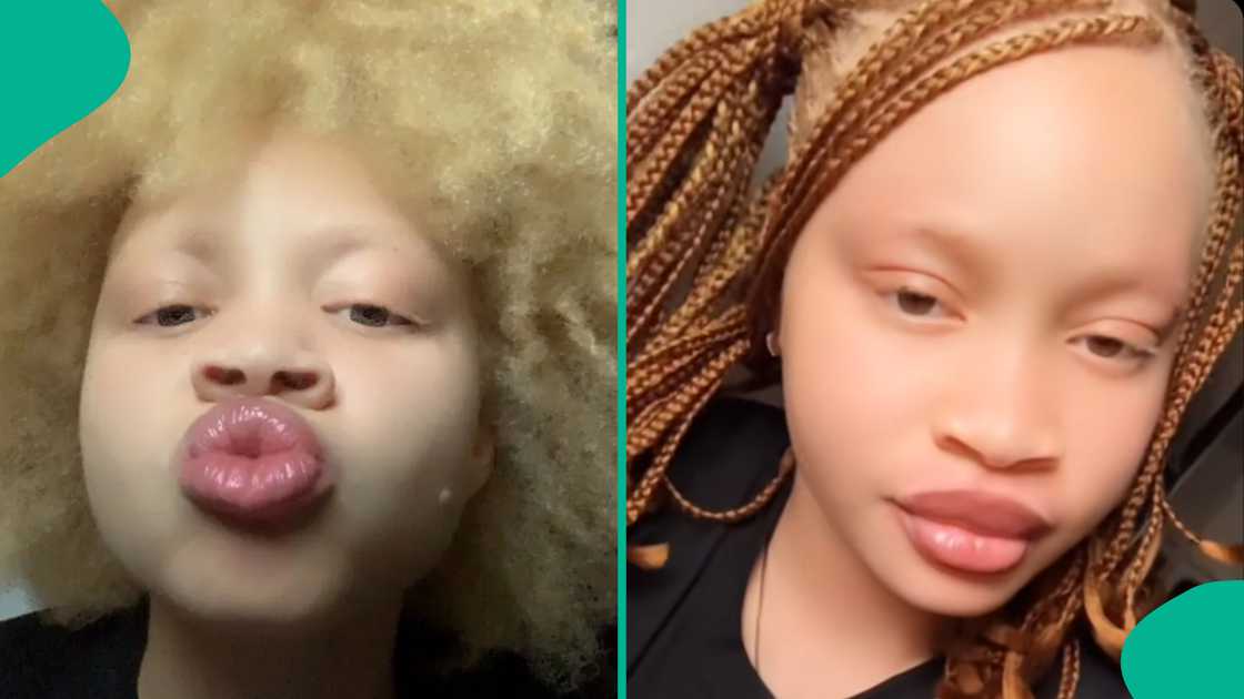 Albino lady’s 2026 UTME result trends online after release. Albino lady’s 2026 UTME result trends online after release.