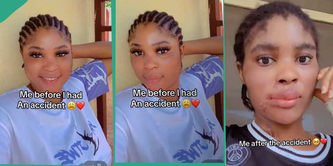 Lady says accident damaged her face. Lady says accident damaged her face.