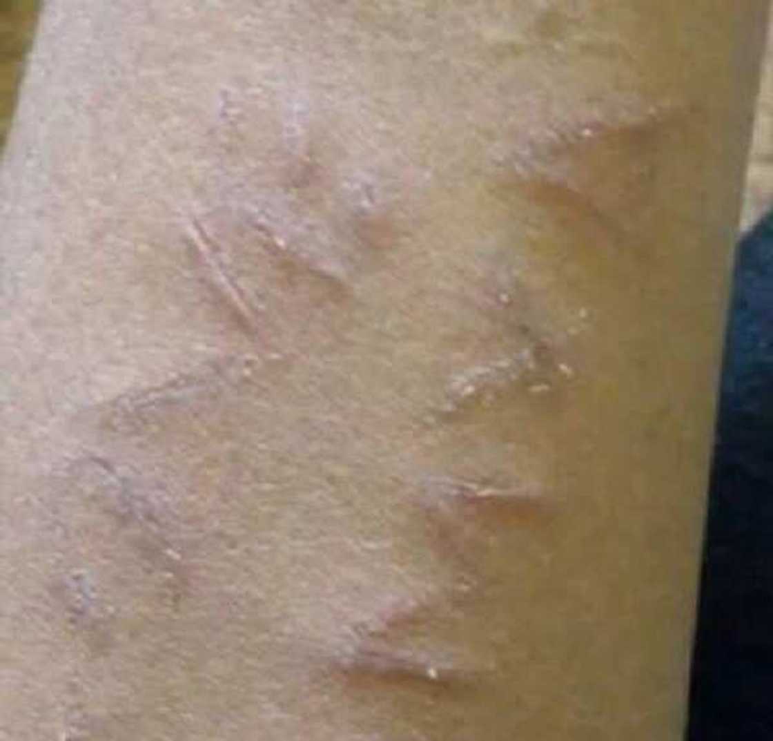 Yarinyar da ya tsaga jikinta da sunan Masoyi ta kawo kararsa Facebook Yarinyar da ya tsaga jikinta da sunan Masoyi ta kawo kararsa Facebook