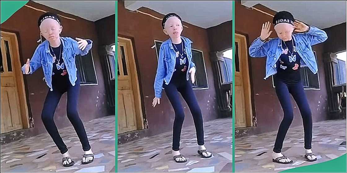 Albino lady shows off her electrifying dance moves