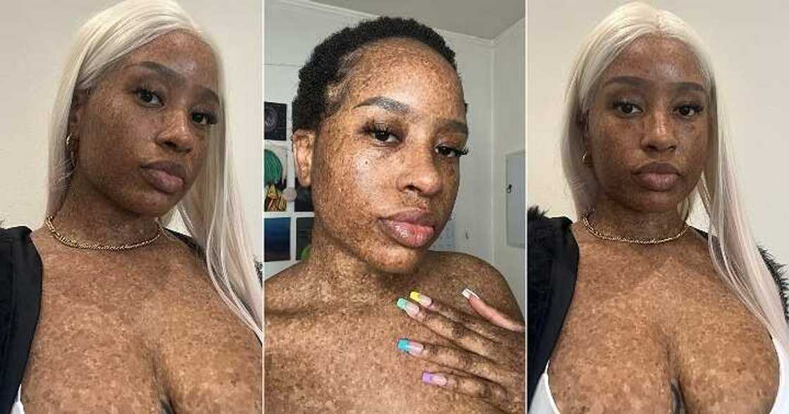 Pretty lady with freckles on her skin Pretty lady with freckles on her skin