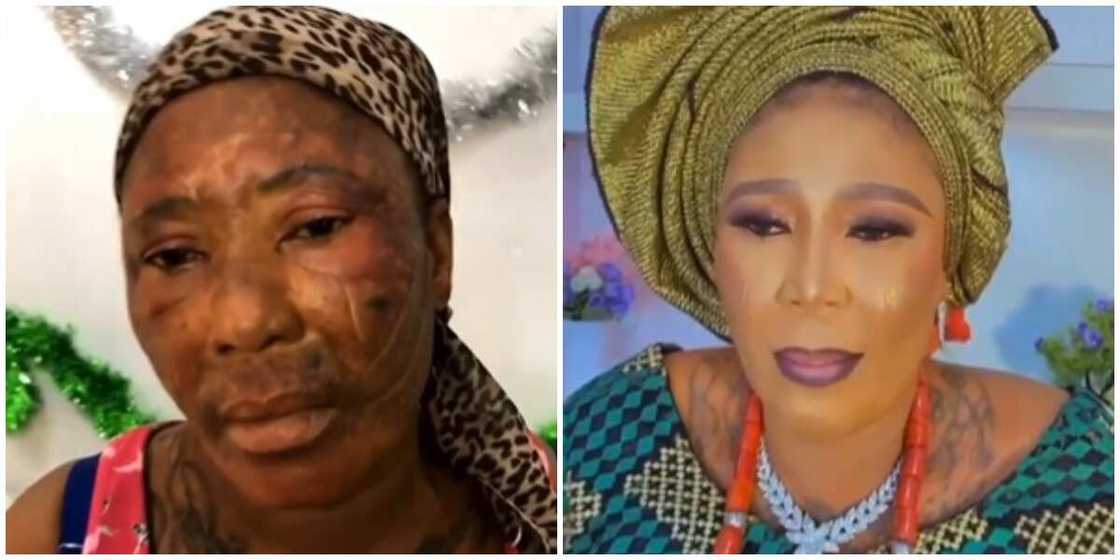 Photos of the lady's before and after transformation. Photos of the lady's before and after transformation.