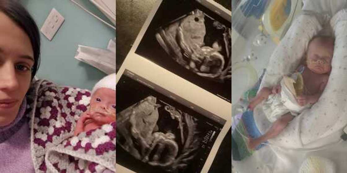 Young Mother Gives Birth Miraculously After Doctors Said Her Baby Had Died In the Womb