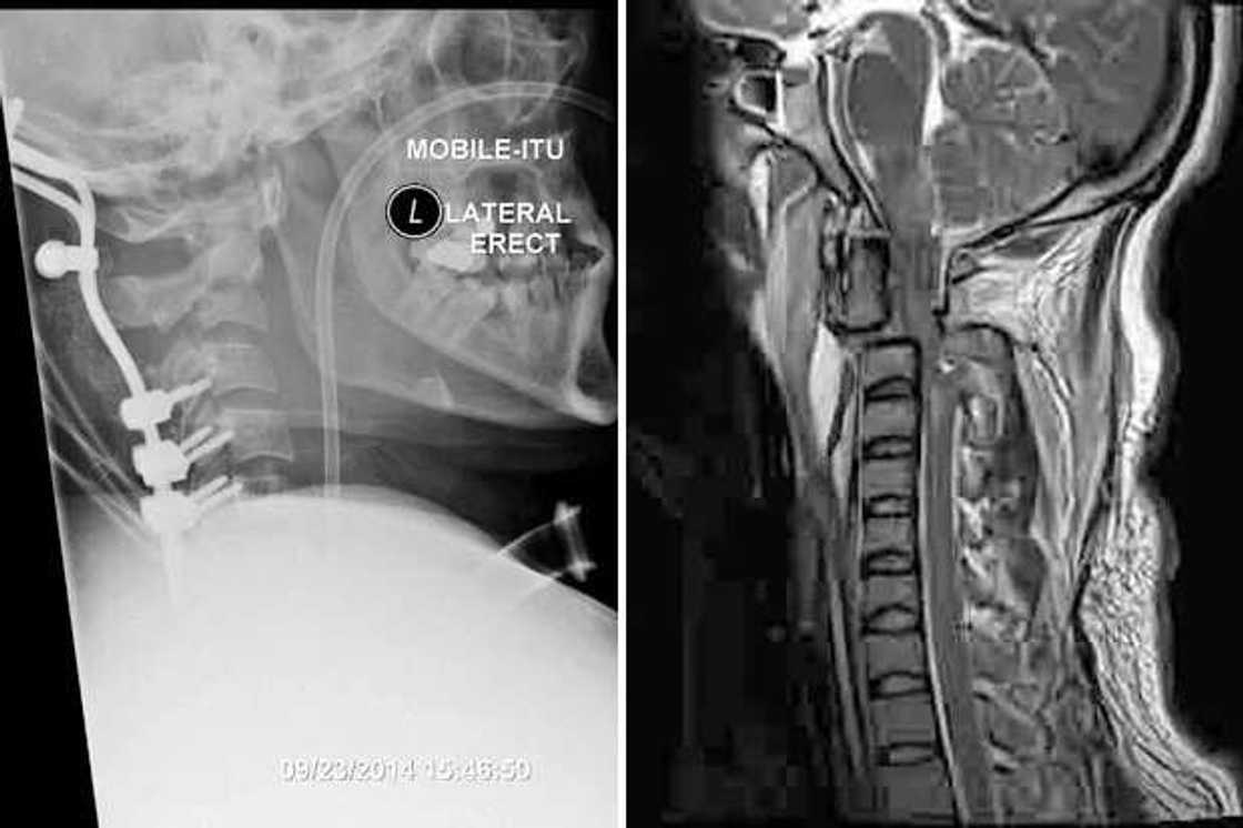 Man's Head Was Ripped Off In Car Crash But He Survives Man's Head Was Ripped Off In Car Crash But He Survives