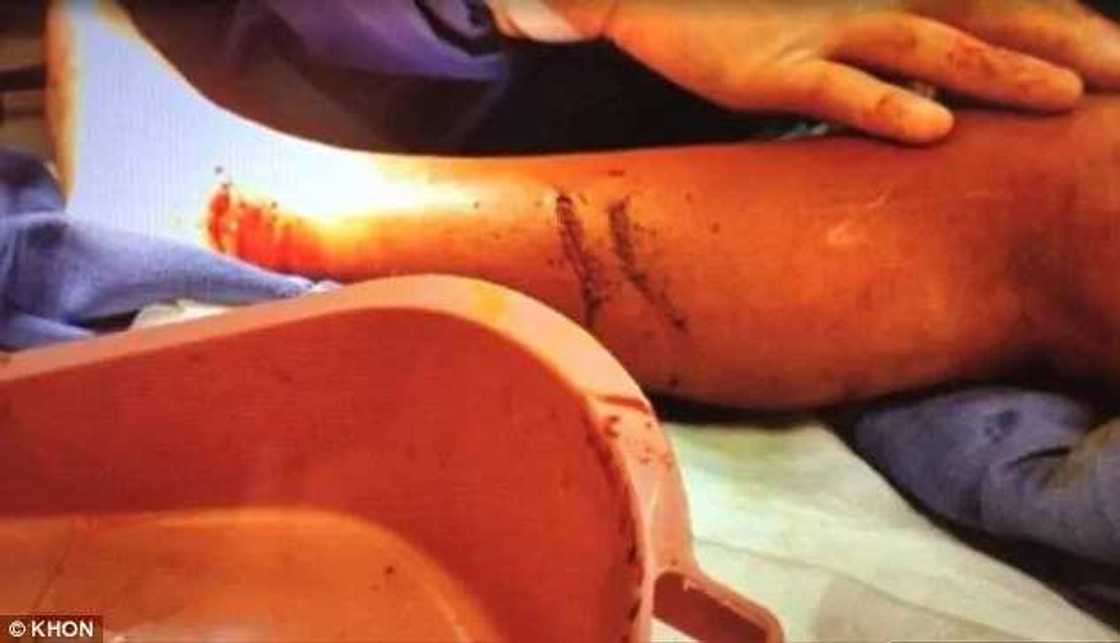 10-Year-Old Boy Survives Shark Attack By Fighting It Back 10-Year-Old Boy Survives Shark Attack By Fighting It Back