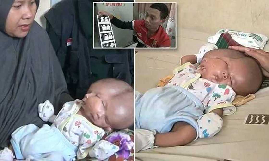 Allah Buwayi: Wata mata ta haifi jariri mai fuska 2, kwalwa 2 amma kai 1 Allah Buwayi: Wata mata ta haifi jariri mai fuska 2, kwalwa 2 amma kai 1