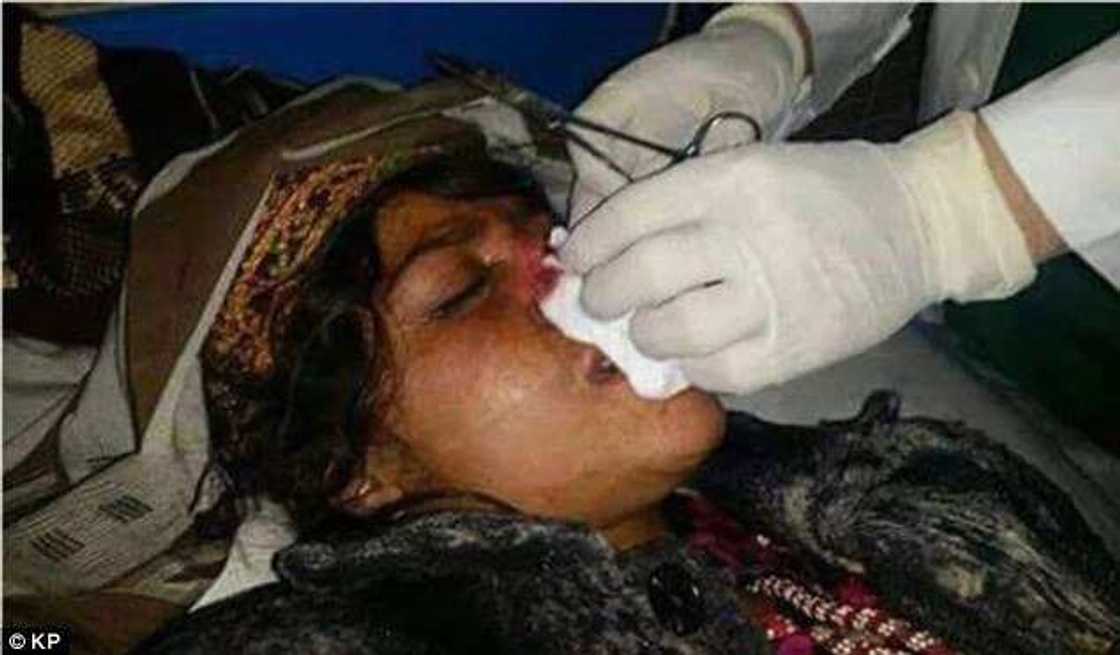 Woman's Nose Cut Off By Her Husband Of Five Years Woman's Nose Cut Off By Her Husband Of Five Years
