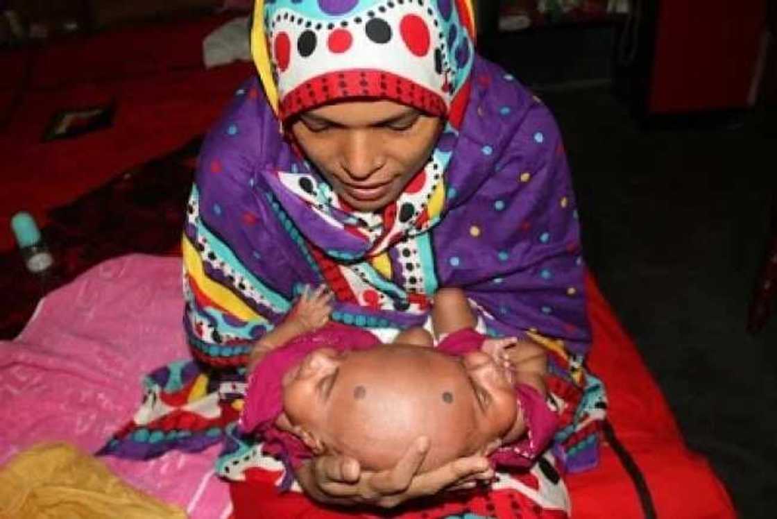 wata mata ta haifi tagwaye masu kai daya a maimakon da daya wata mata ta haifi tagwaye masu kai daya a maimakon da daya