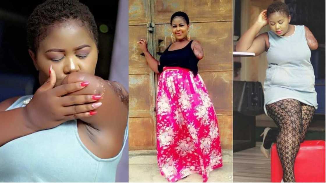 Himma bata ga raggo: Kalli hotunan wata budurwa marar hannu amma tana wanki Himma bata ga raggo: Kalli hotunan wata budurwa marar hannu amma tana wanki