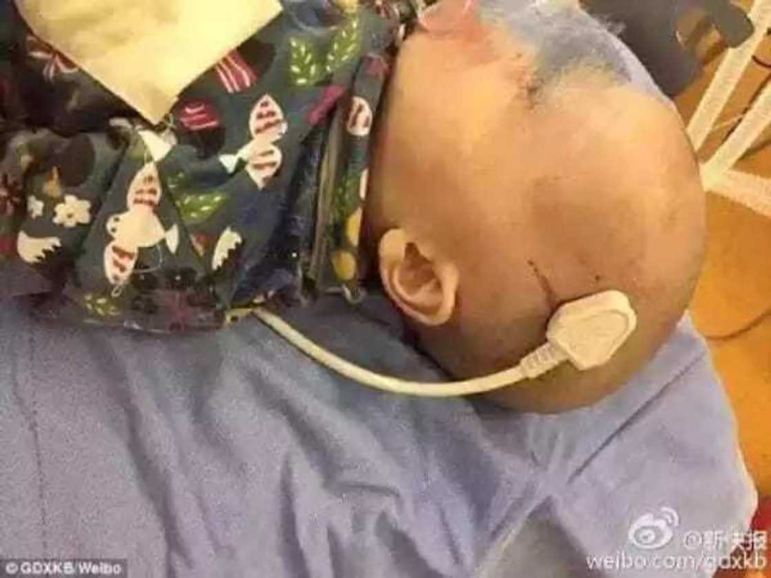 Kan wayar wuta ya caki kan Jariri Kan wayar wuta ya caki kan Jariri