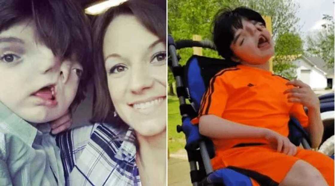 Zul waja haini: Yaro mai fuska 2 ya cika shekaru 13 (Hotuna) Zul waja haini: Yaro mai fuska 2 ya cika shekaru 13 (Hotuna)