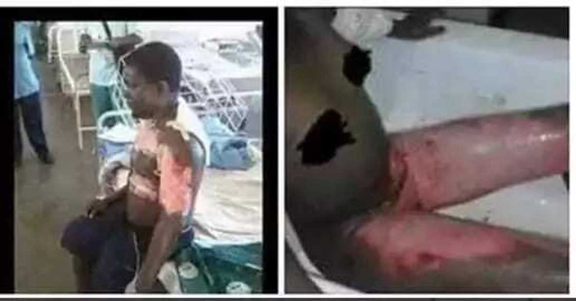 Wani mutum ya kone alokacin dayake amsa waya a kicin Wani mutum ya kone alokacin dayake amsa waya a kicin