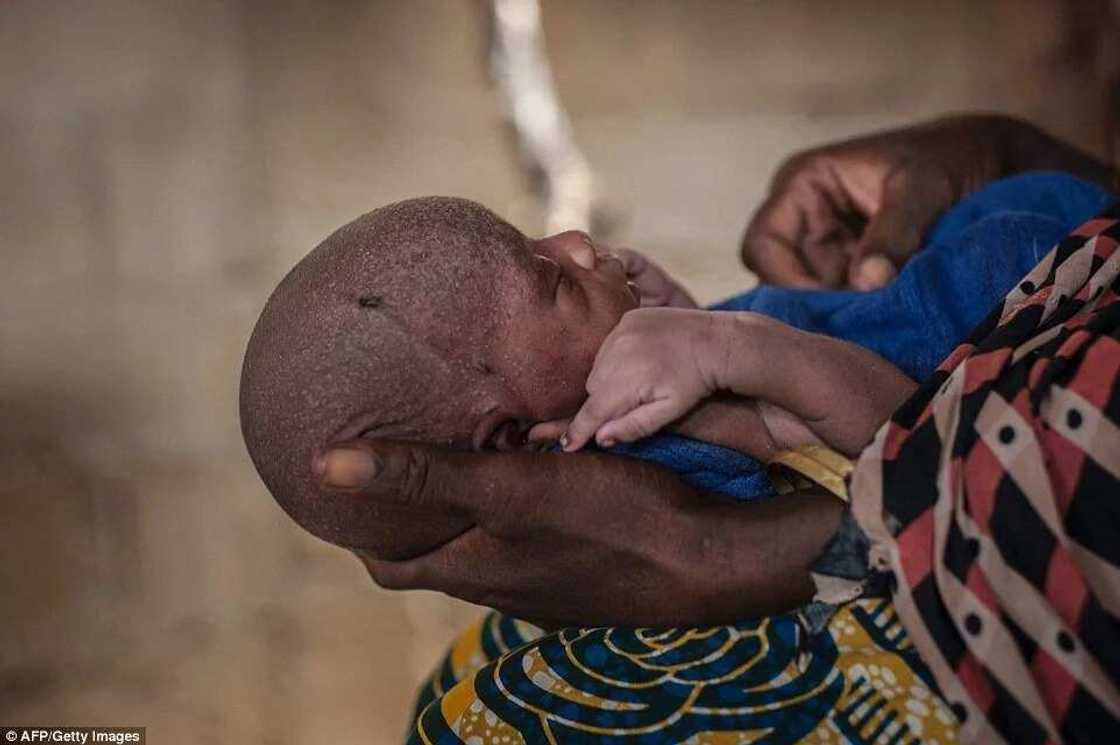 Malnutrition crisis hits IDP camps in Borno