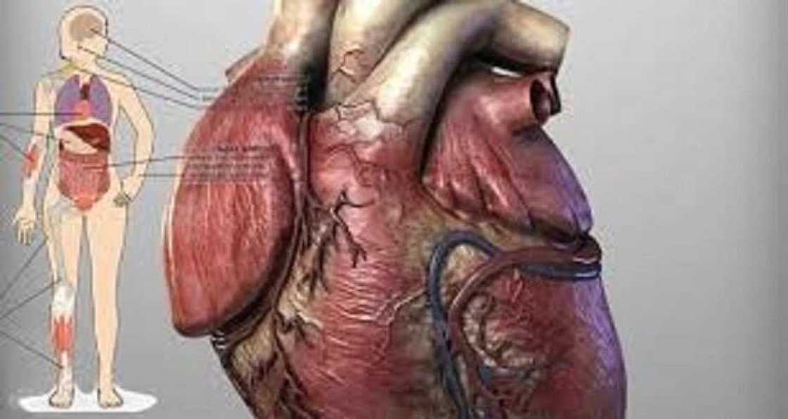 Ayi hattara: Ciwon Zuciya ya kusa kama duk mai aikata abubuwan da wani Masani ya fada Ayi hattara: Ciwon Zuciya ya kusa kama duk mai aikata abubuwan da wani Masani ya fada