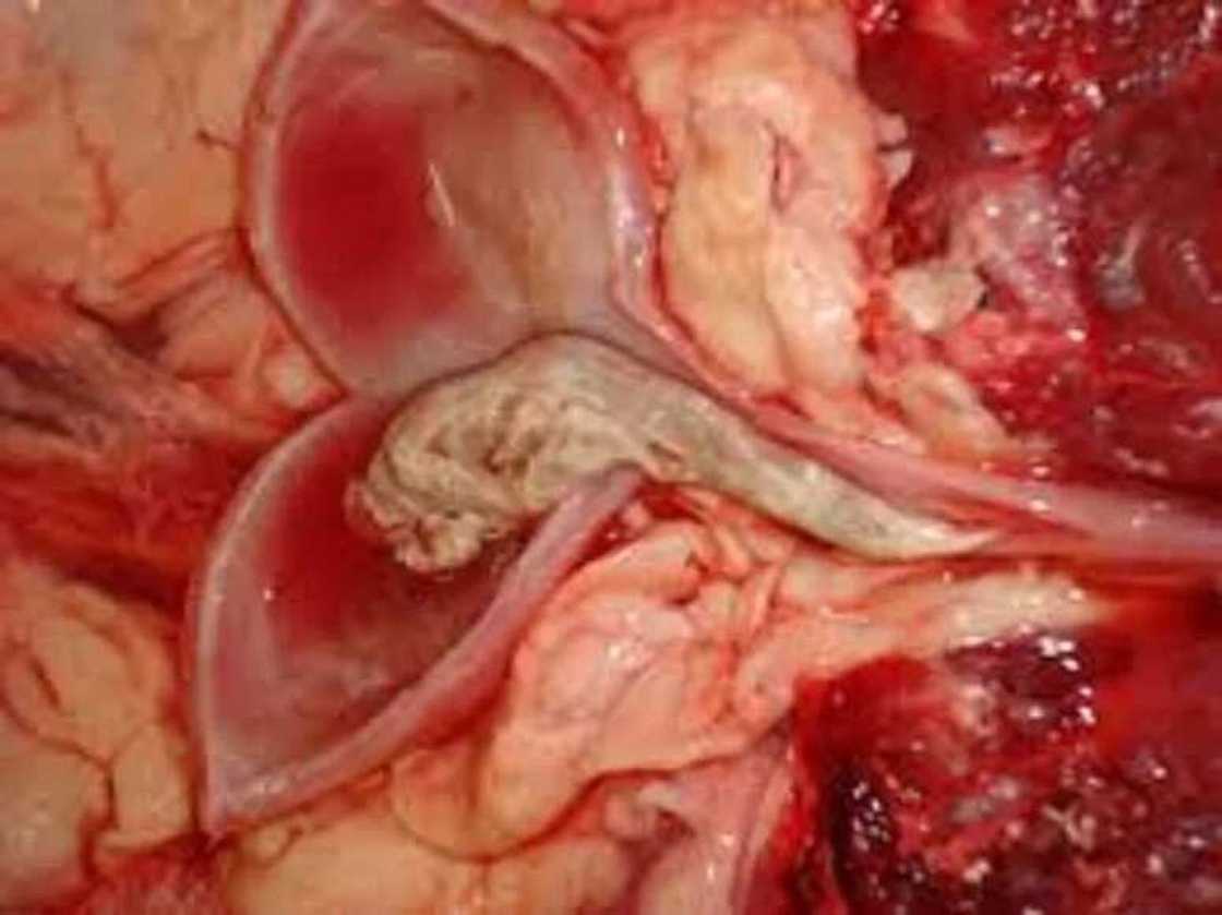 Tabdijan:Tabdijan: Mafi yawancin Mutane basu san haka rikon fitsari ke da illa ba Tabdijan:Tabdijan: Mafi yawancin Mutane basu san haka rikon fitsari ke da illa ba