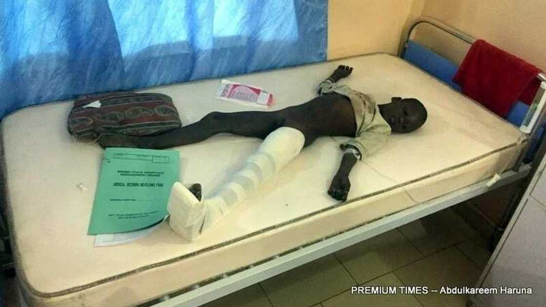 Victims of IDP camp bombing in hospital Victims of IDP camp bombing in hospital